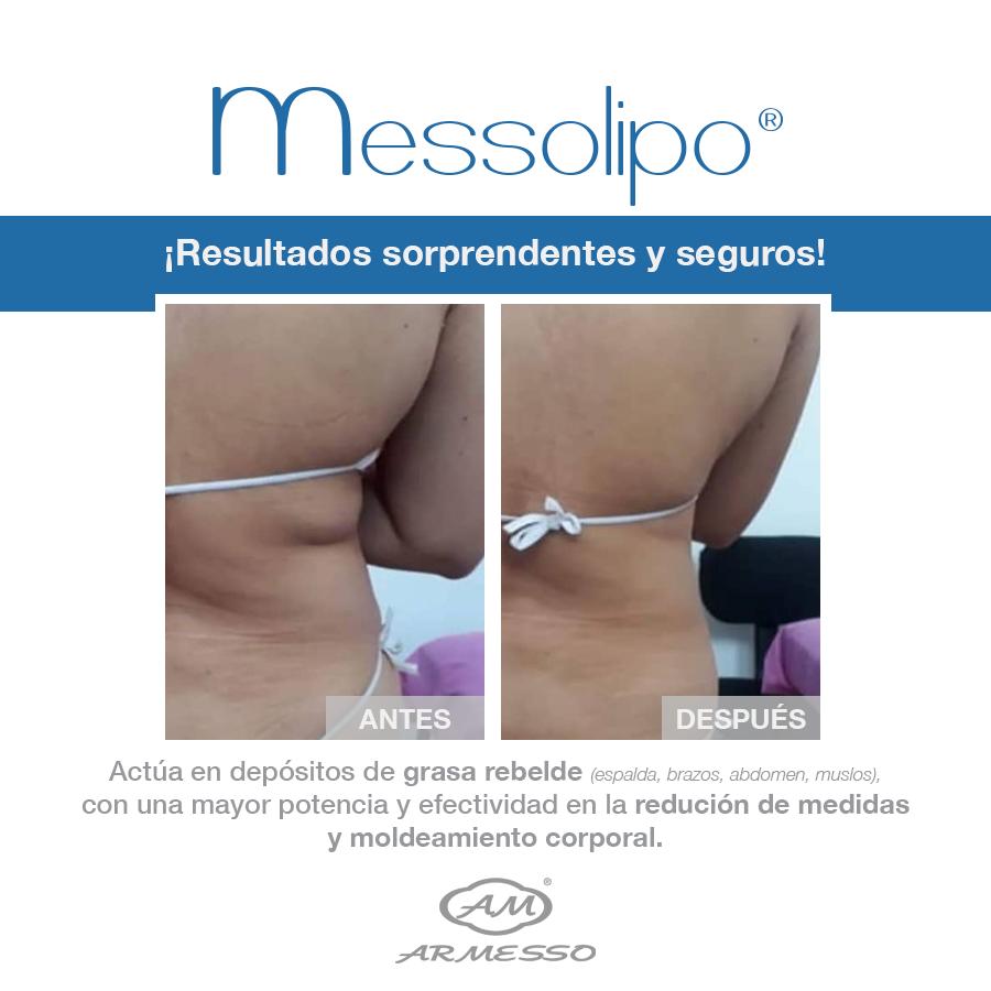 MESSOLIPO VIAL 10ML Armesso